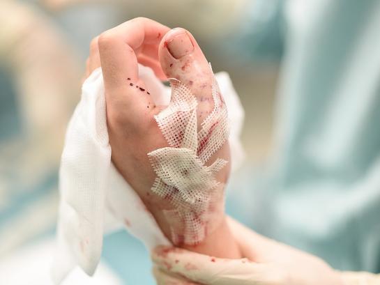 Orthopedie AZ Sint-Jan handchirurgie